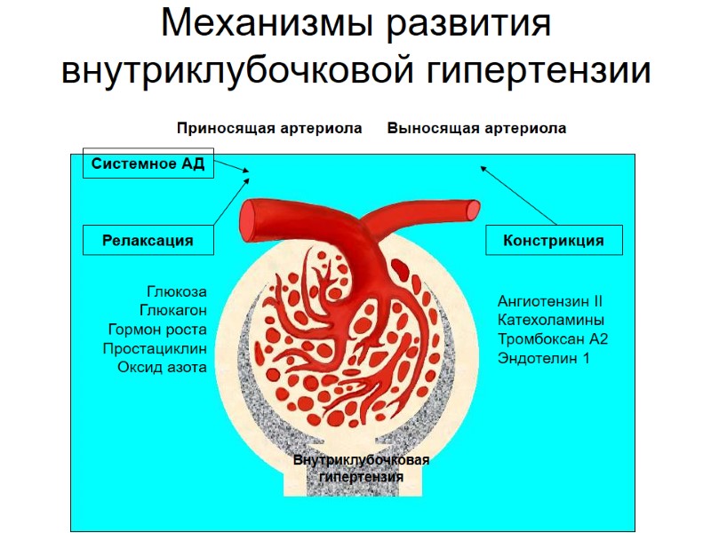 Механизмы развития внутриклубочковой гипертензии Внутриклубочковая гипертензия Ангиотензин II Катехоламины Тромбоксан А2 Эндотелин 1 Глюкоза